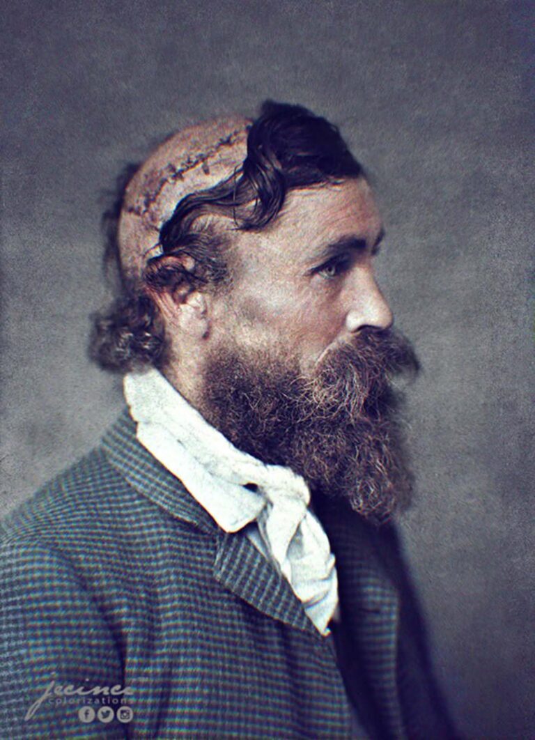 The Remarkable Survival Story of Robert McGee: From Scalping to Resilience