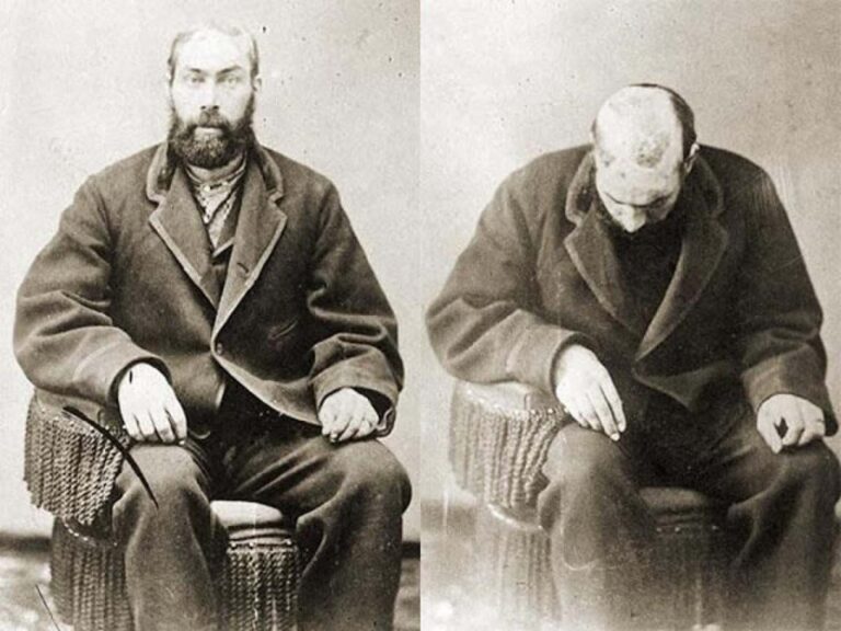 Robert McGee: The Man Who Overcame the Odds After Being Scalped